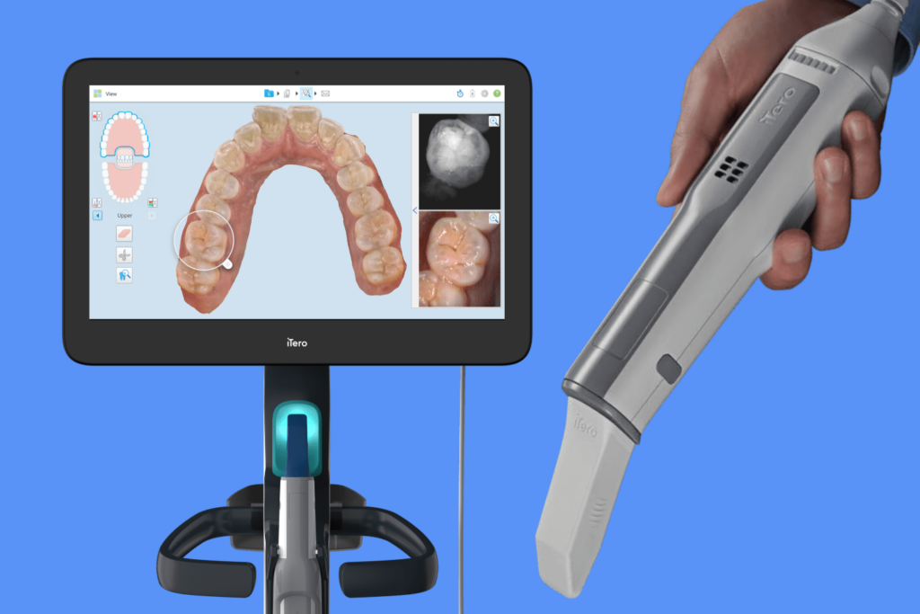 itero invisalign scanner Dental Equipment
