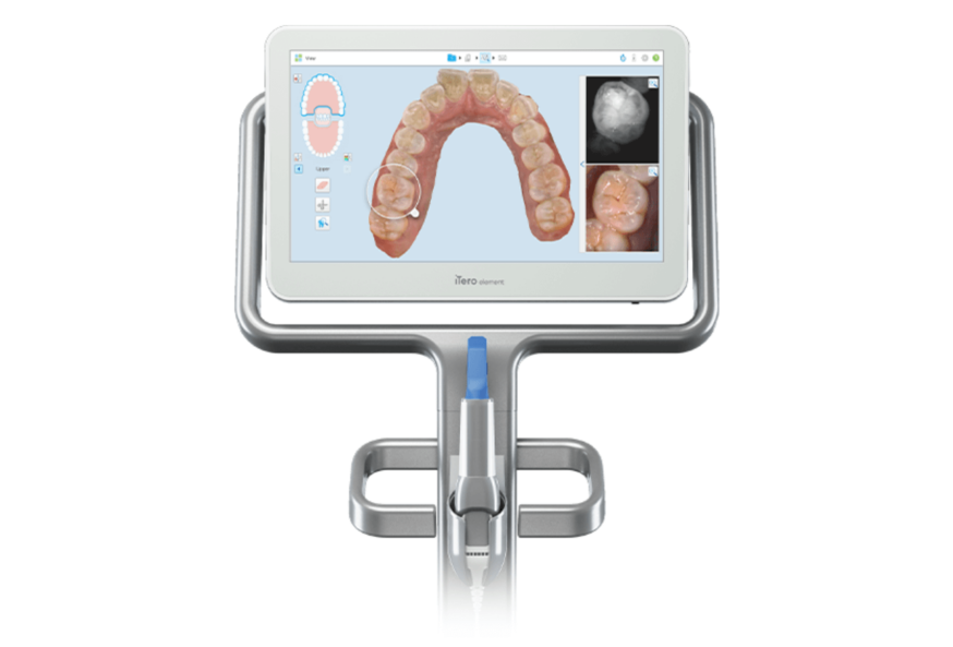 itero invisalign scanner
