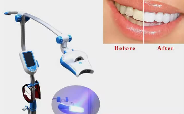 machine to whiten teeth
