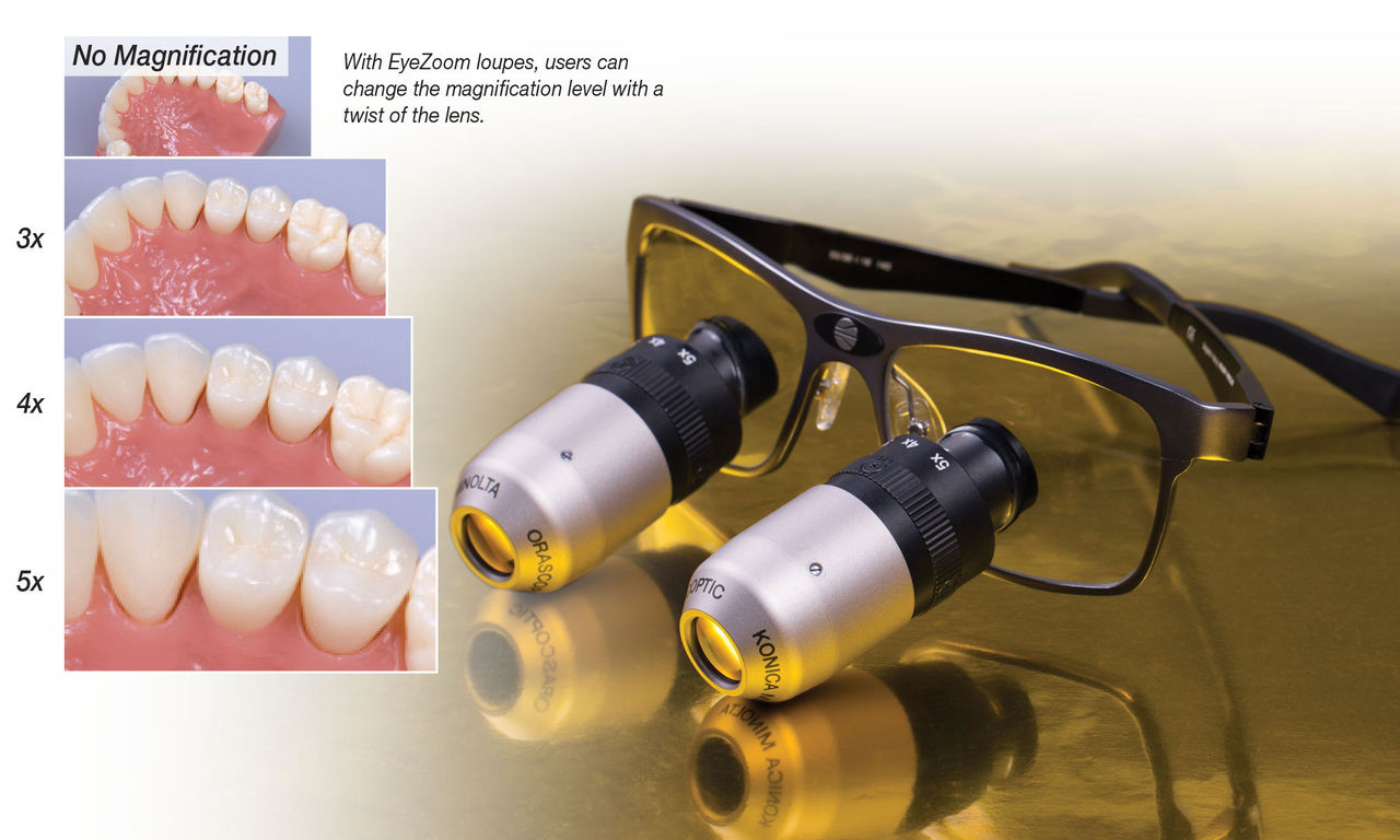 magnification loupes in endodontics