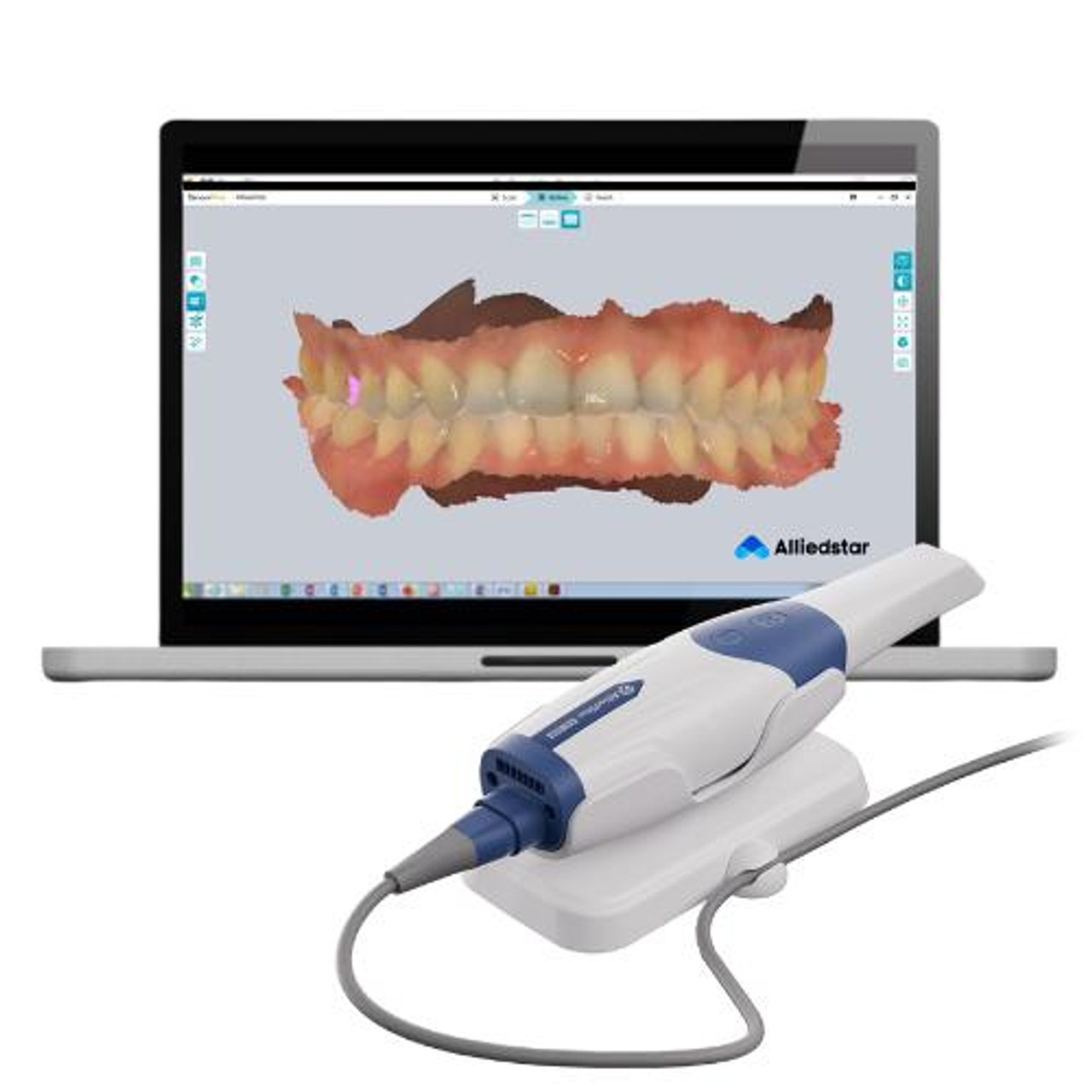 orthodontic scanner